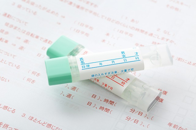 便潜血検査とは？
